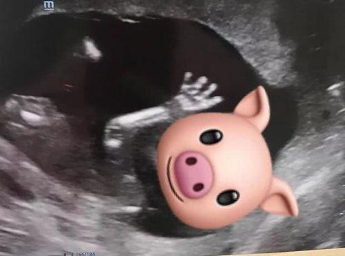 肥猪猪的日常娱乐吃瓜,娱乐至上，笑料连连